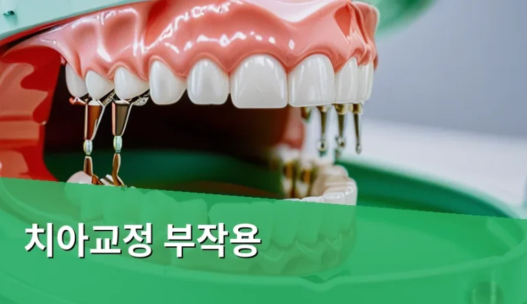 치아교정 부작용 예방을 위해 정기 검진이 필요한 이유